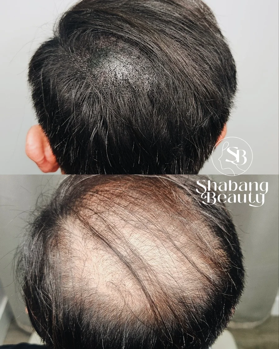 Shabang Beauty client result 7